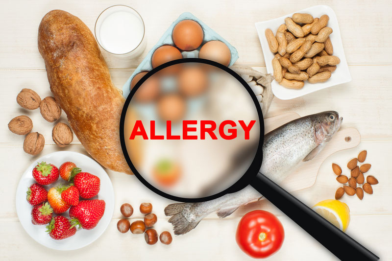Wilmington, CA 90744 food allergies and sensitivity treatment